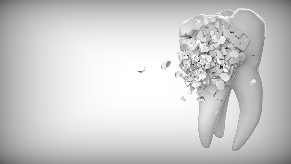 Implanty zębów – jaki materiał wybrać?